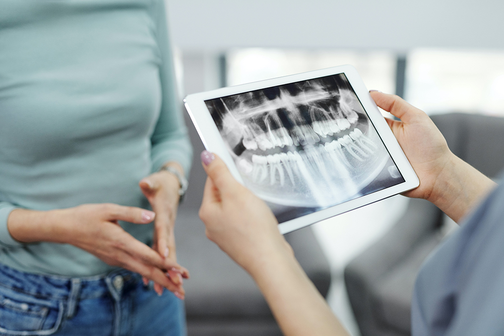 Radiografia dentară – ce trebuie să știi despre această investigație